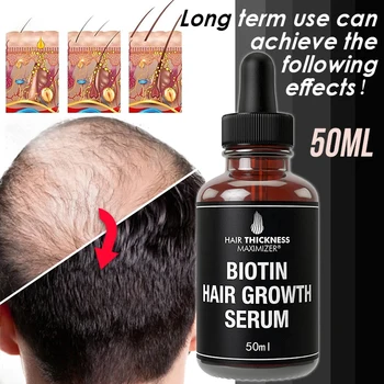 Предпазва от косопад и стимулира растежа на косата. Това е оригинална автентичната 100% течност за загуба на коса и гъста копър за растеж на косата